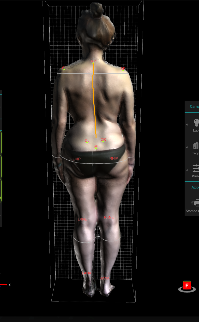 Analisi posturale 3D con Spine 3D